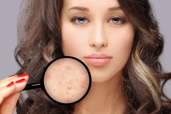 Scars Treatment