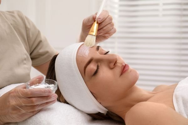 Chemical Peel